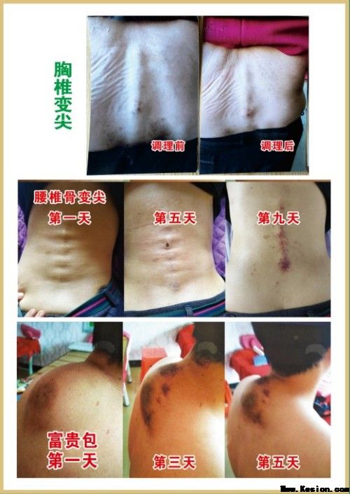 礼赞八一专题报道 著名国医大师---杨宗仙