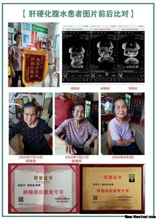 礼赞八一专题报道 著名国医大师---杨宗仙