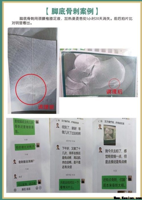 礼赞八一专题报道 著名国医大师---杨宗仙