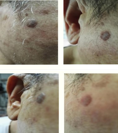 记量子氢氧健康第一人 长寿哥（廖永贵）