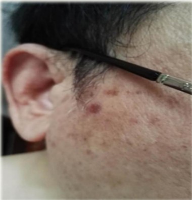 记量子氢氧健康第一人 长寿哥（廖永贵）