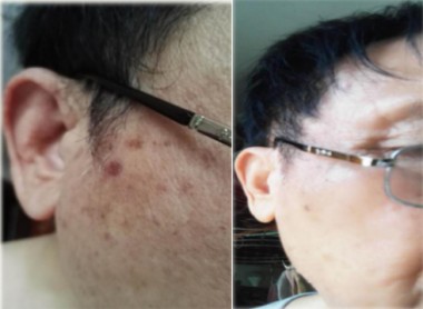 2025新春专题报道 量子氢氧健康第一人长寿哥（廖永贵）