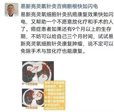 吃药打针降糖治不好糖尿病 易新亮灵氧细胞靶向针灸却能逆转三高断药