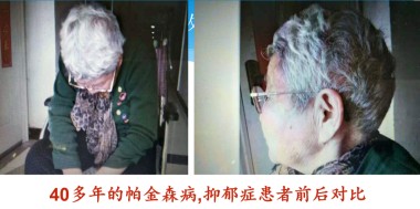 2025喜迎新春特别报道 中医骨膜消结术创始人---潘杏富