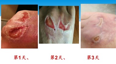 2025喜迎新春特别报道 中医骨膜消结术创始人---潘杏富