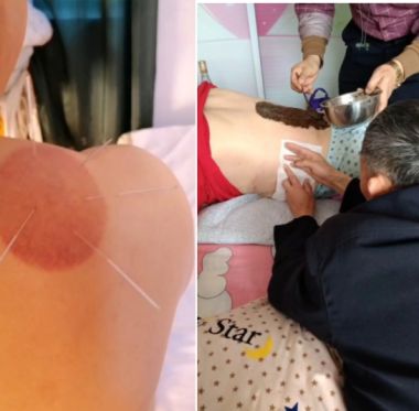 建国75周年特别报道 扎根乡土的民间中医---韩秀能