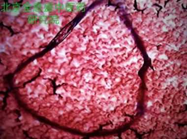 袁道彬 全息血液检测及干预法研究技术