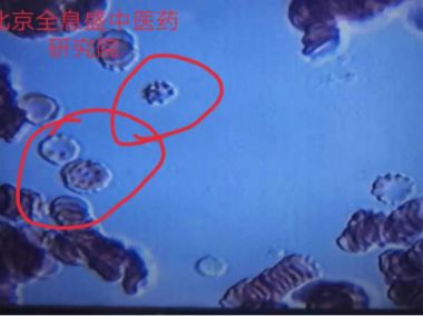袁道彬 全息血液检测及干预法研究技术