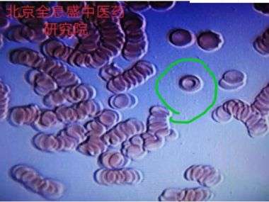 袁道彬 全息血液检测及干预法研究技术