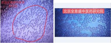 袁道彬 全息血液检测及干预法研究技术